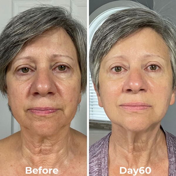 Before and After Results 3