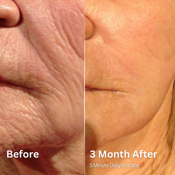 Before and After Results 4