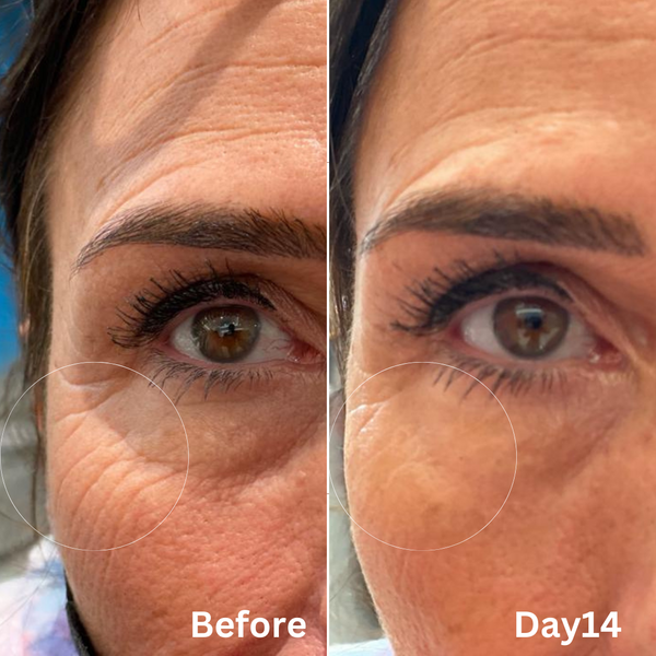 Before and After Results 1