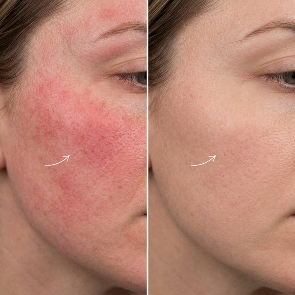 Before and After Results 3