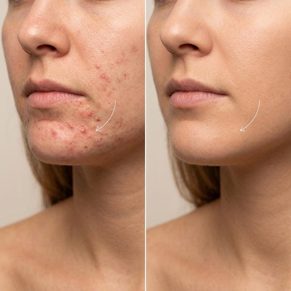 Before and After Results 4
